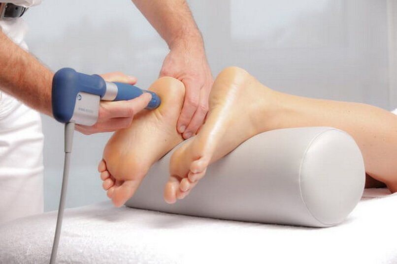 Perform shock wave therapy