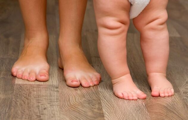Deformation of the foot in children